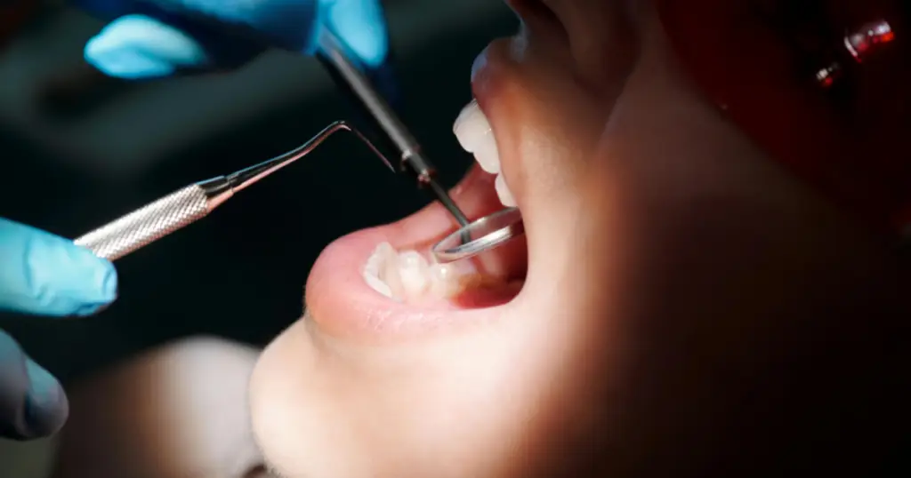 Can Invisalign cause TMJ
