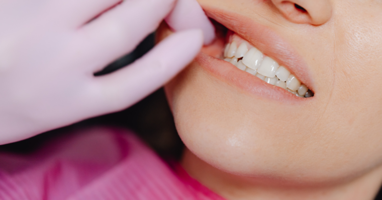 are dental implants magnetic
