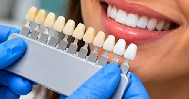 how teeth whitening works